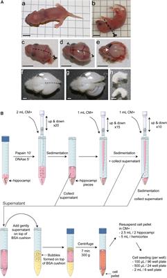 Procedures for Culturing and Genetically Manipulating Murine Hippocampal Postnatal Neurons